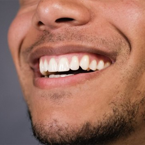 a man smiling with healthy teeth and gums