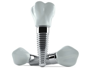 One dental implant standing up and two lying down